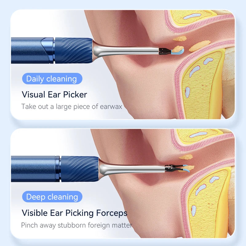 optivis™ Ear Cleaner with Camera | S3 Pro